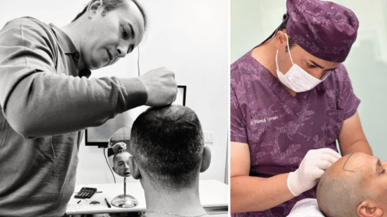 5 Reasons to Choose a Hair Transplant Turkey